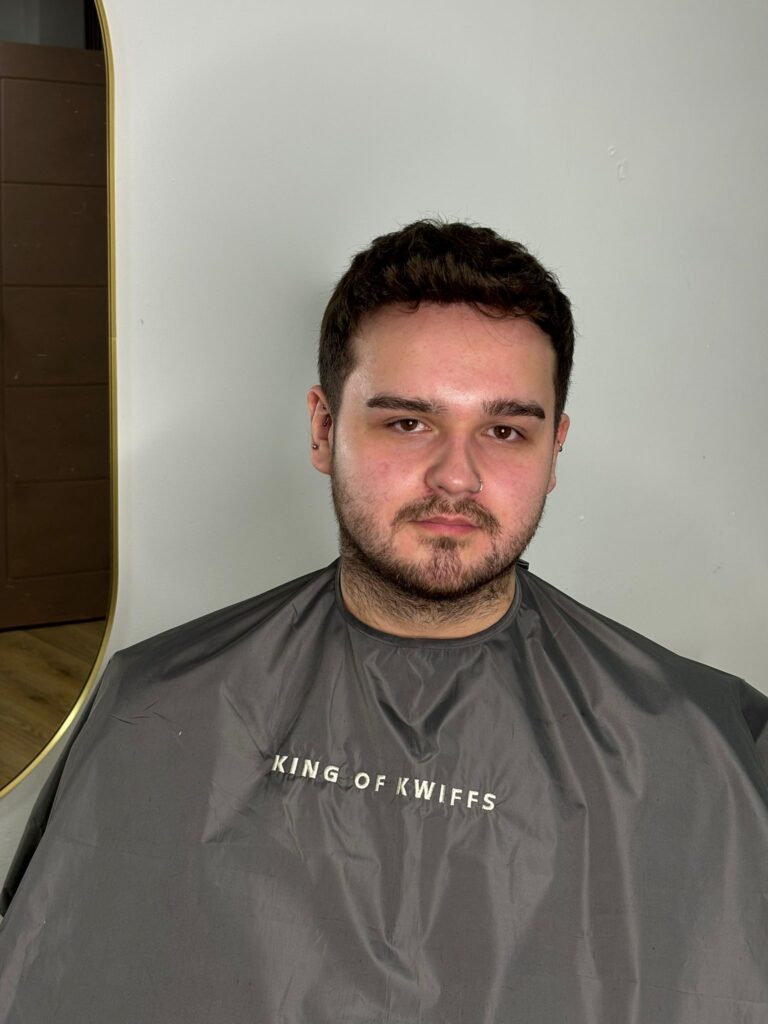 mens hair system after oxford