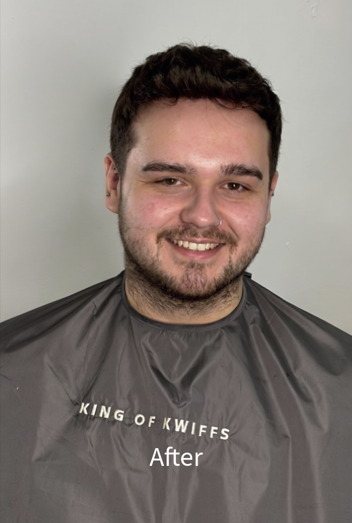 After: men's hair system fitted at Wisteria Avenue, Abingdon