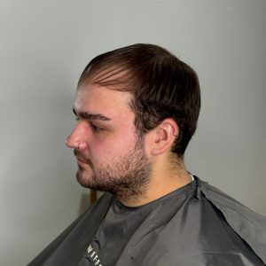 mens hair system before oxford
