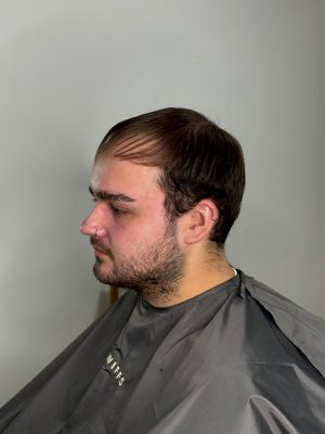 mens hair system before oxford